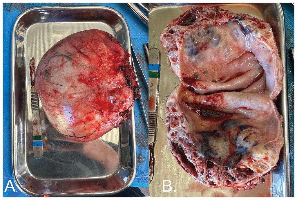 ovarian abnormality in a mare